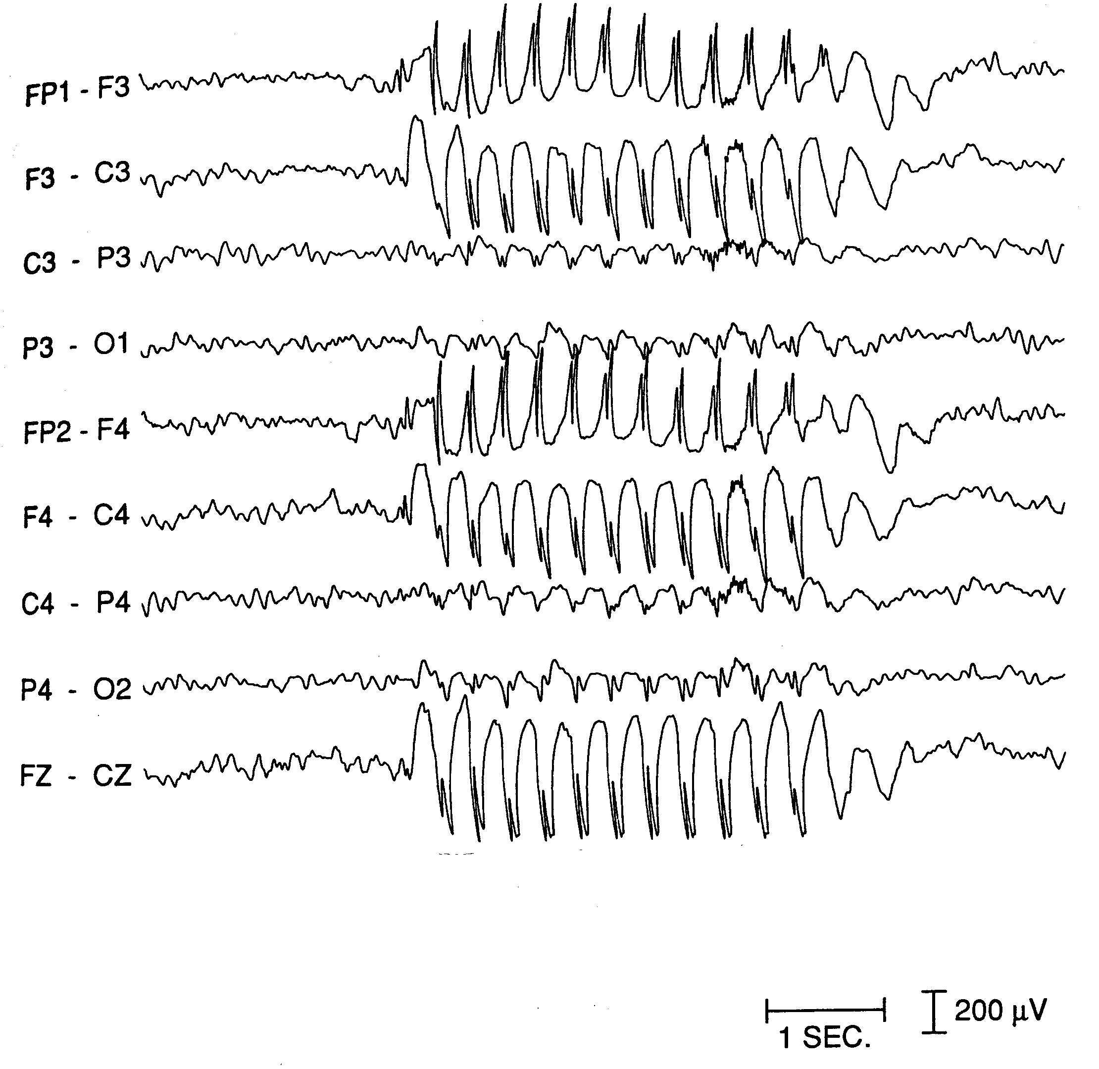 what does an eeg show